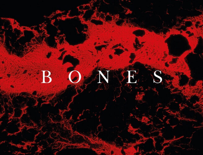 Video di “Bones” dei The Silence Between Us